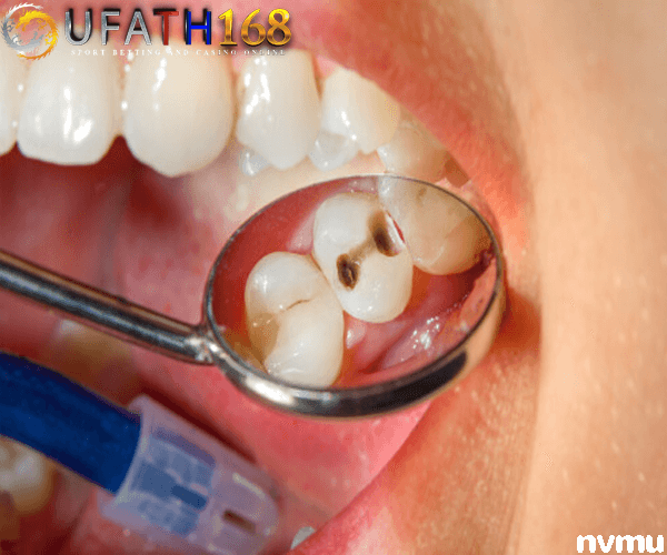 แมงกินฟันคืออะไร เกี่ยวกันไหมกับฟันผุ